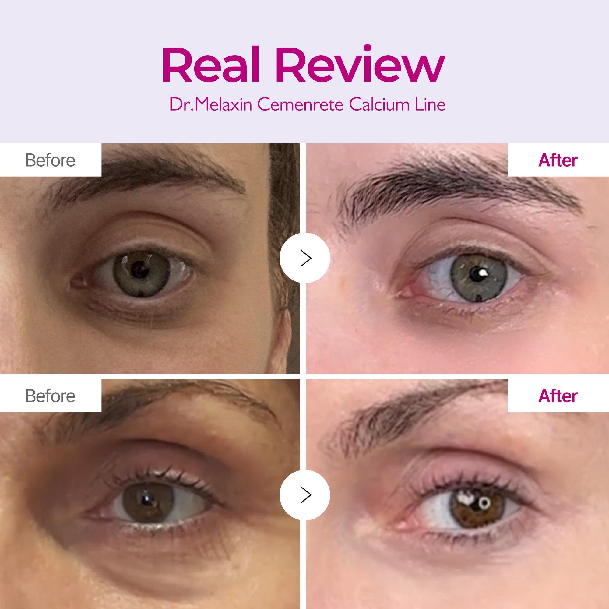 Cemenrete Calcium Intense Cream
