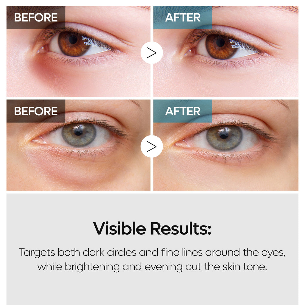 TX-Retinalsome Double Effect Eyecream