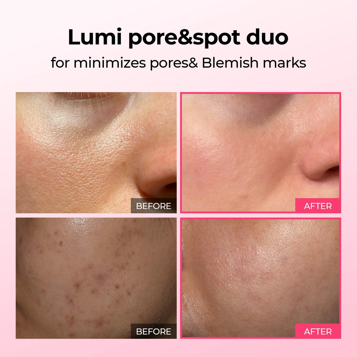 Duo Lumi Pore & Spot Care Duo